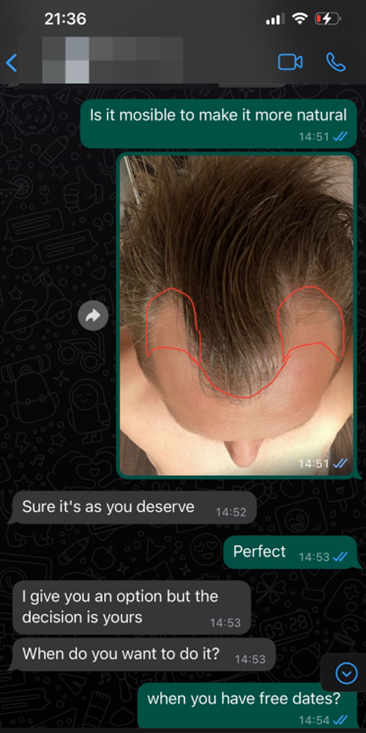 whatsapp klinika przeszczepu włosów 4