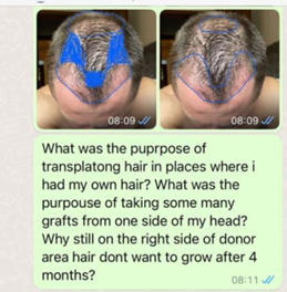 wiadomość whatsapp klinika przeszczepu włosów 6